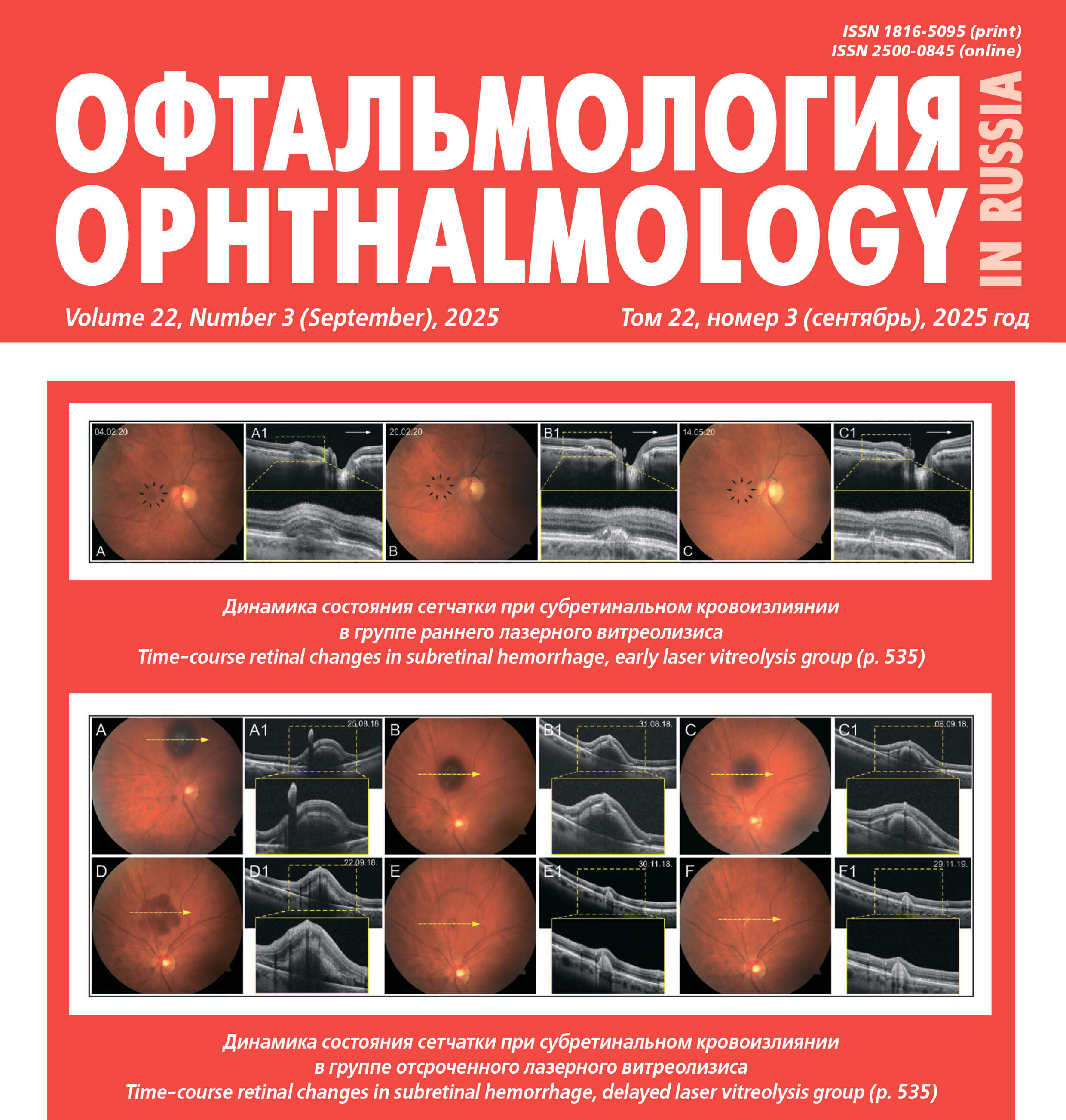 Клинические и функциональные критерии состояния жизнедеятельности больных и инвалидов с пресбиопией