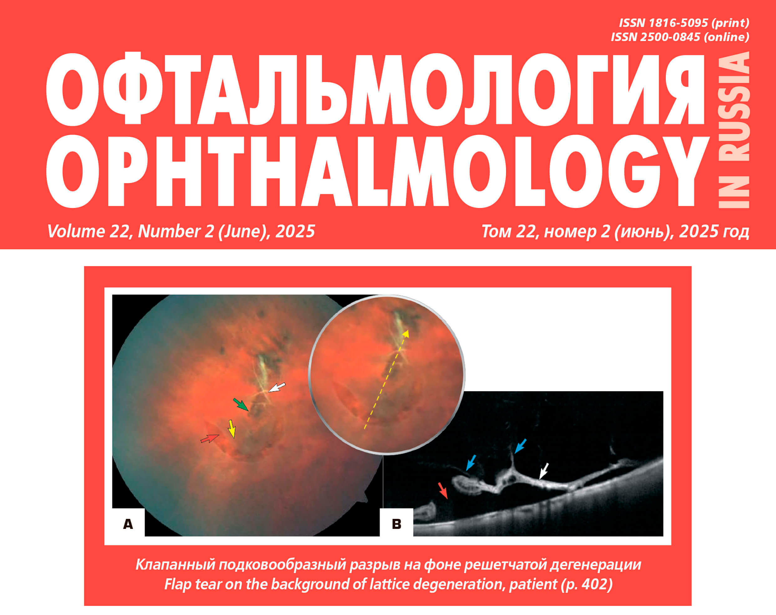 Клинические и функциональные критерии состояния жизнедеятельности и возможности реабилитации больных и инвалидов с возрастной катарактой